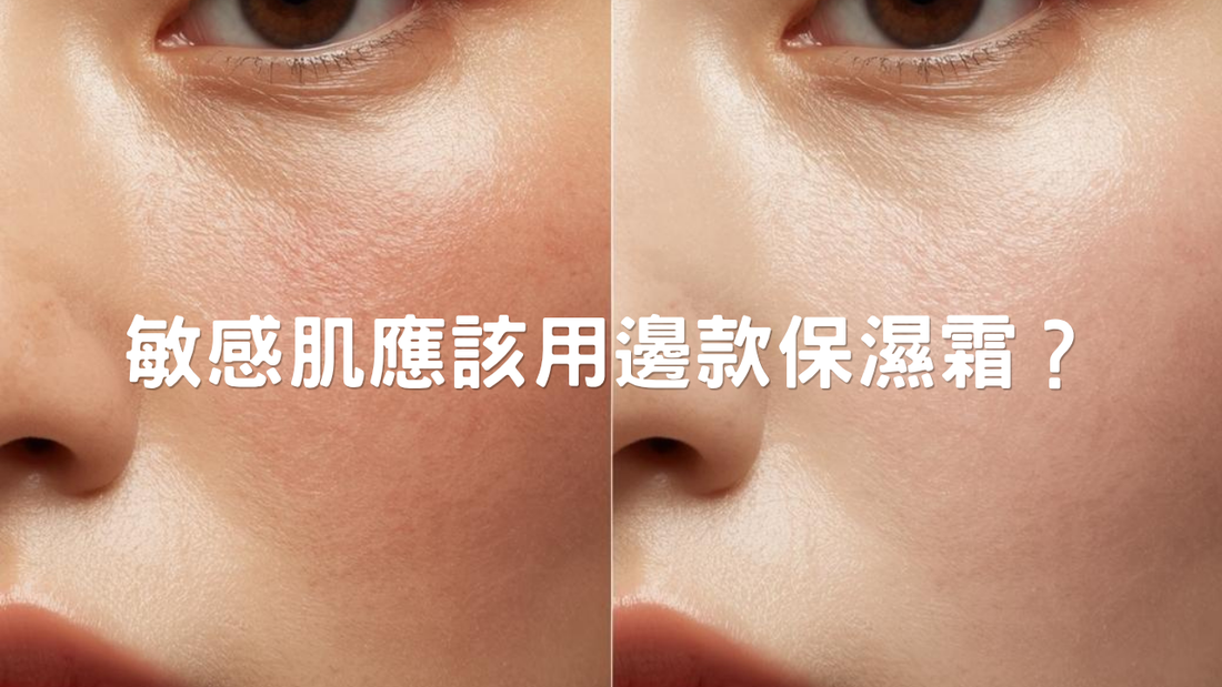 敏感肌應該用邊款保濕霜？清爽vs滋潤點揀？